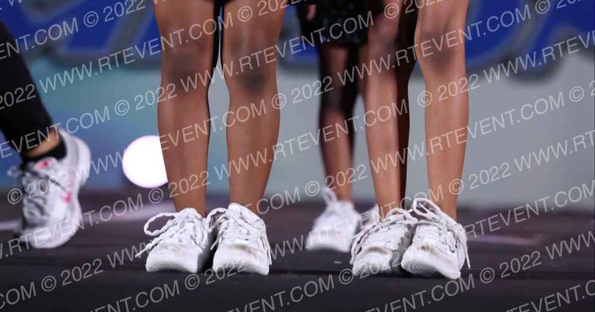 The Xtreme Girls Kisses · Athletic Atlanta Nationals